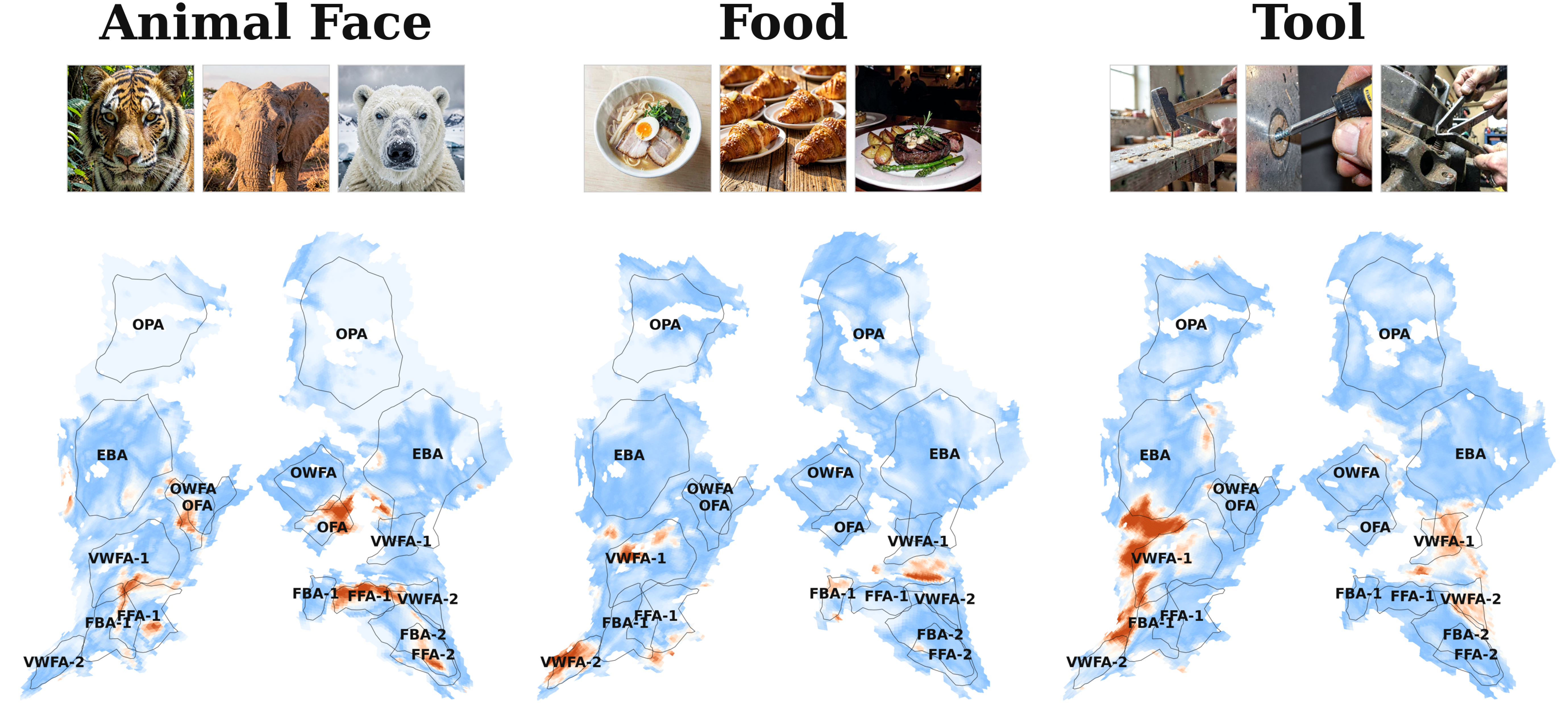 Figure 5: 인과적 점수 기반 뇌 지도