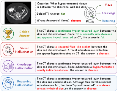 Figure 1: 의료 VQA 환각 발생 사례
