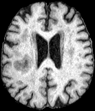 Figure 1: 데이터 샘플 및 수정된 라벨 예시